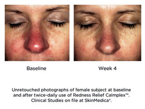 Before and After Images