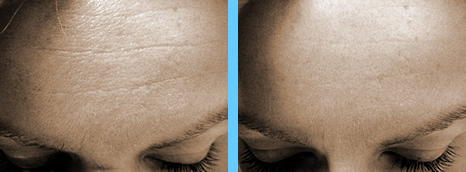 Before and After Images