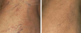 Before and After Images