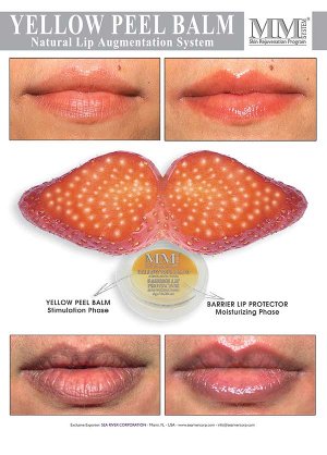 Yellow Peel Balm