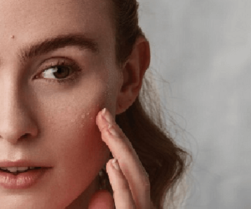 How To Get Rid Of Redness On Your Face & What's Causing It