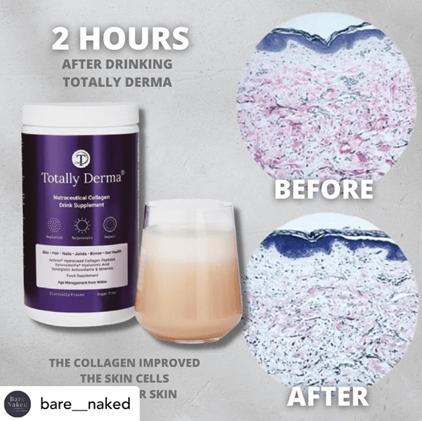 Should I Take Collagen Supplements? The Pros, Cons, and More