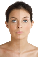 Pigmentation