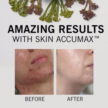 Advanced Nutrition Programme Skin Accumax - 180 Capsules
