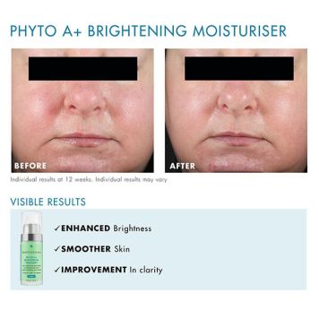 SkinCeuticals Phyto A+ Brightening Treatment