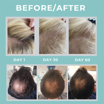 Cebelia Anti-Hair Loss Lotion