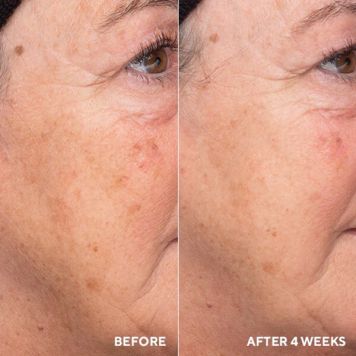 HydroPeptide Liquid Resurfacing Solution