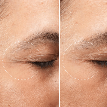 Medik8 Crystal Retinal Ceramide Eye 3 