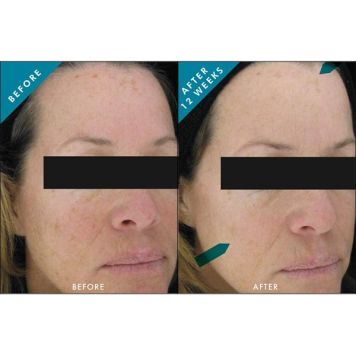 SkinCeuticals  Phloretin CF Gel 