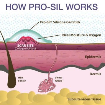 Biodermis Pro-Sil glide-on Silicone Scar Stick 17g   