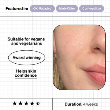 Advanced Nutrition Programme Skin Accumax - 120 Capsules