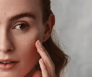 Supplements to help calm Rosacea 