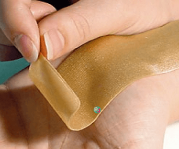 How Long to Wear Silicone Sheets for Scars?