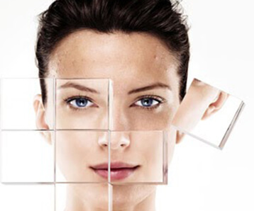 Hyperpigmentation 101: Causes, Treatments And Prevention