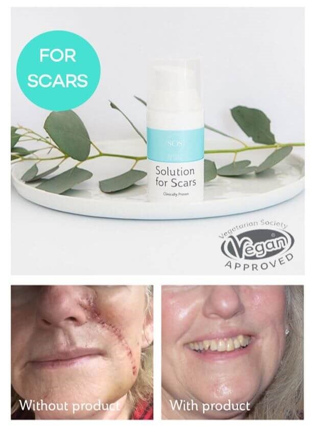 Solution For Scars
