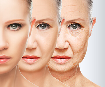 What causes Wrinkles?