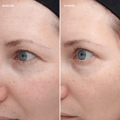 Colorescience shop total eye
