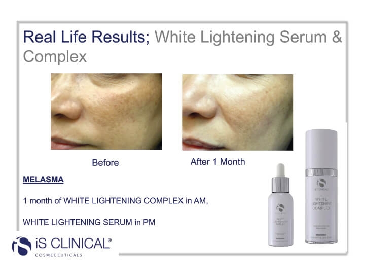 White Lightening Complex before and after image of face