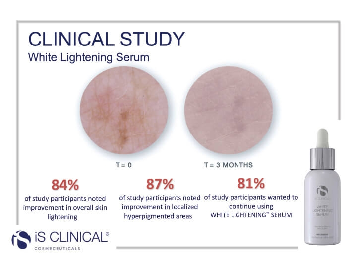 White Lightening Serum before and after image