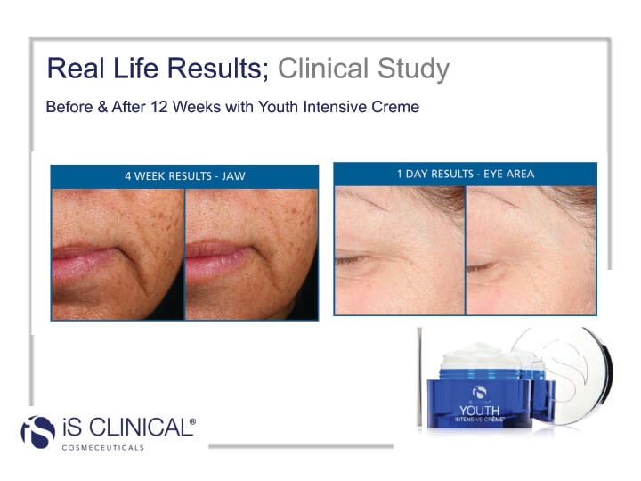 iS Clinical Youth Intensive Creme before and after image of jaw and eye area iS Clinical Youth Intensive Creme before and after image of jaw and eye area