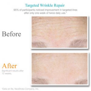 exuviance-targeted-wrinkle-repair