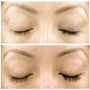 Before and After Images