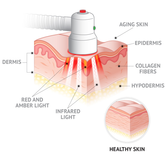 skin