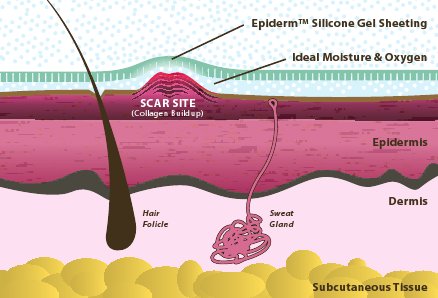 epi-derm