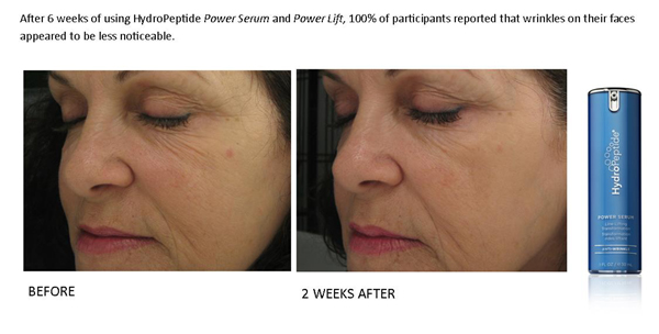 power serum results