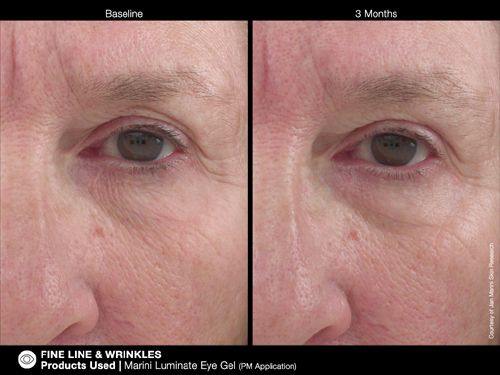 jan Marini Luminate Eye Ge before and after