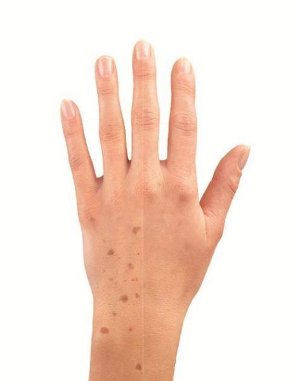 spotner hand